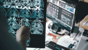 Fighting Alzheimer’s disease with memory-driven computing