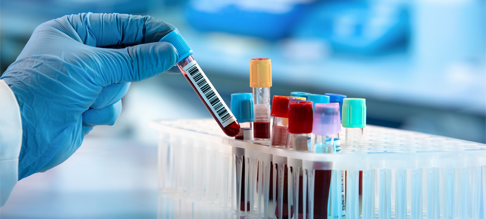 USFDA grants Breakthrough Designation for blood test to help diagnose brain tumors