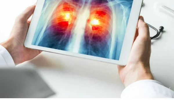 Patients across Europe access robotic-assisted bronchoscopy with Ion endoluminal system